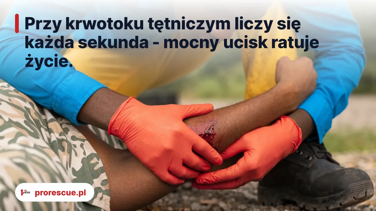 Przy krwotoku tętniczym liczy się każda sekunda - mocny ucisk ratuje życie. - krwotok zewnętrzny pierwsza pomoc